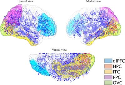 Neural Substrates of External and Internal Visual Sensations Induced by Human Intracranial Electrical Stimulation